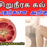 சிறுநீரக கற்களின் அறிகுறிகள் தமிழில்