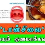 டான்சில்லிடிஸ் என்றால் என்ன